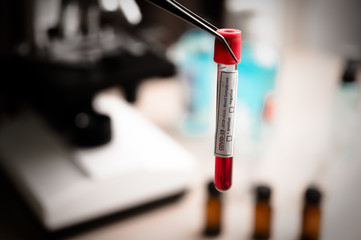 COVID-19 blood sample test, 2019-nCoV Coronavirus check-up in laboratory