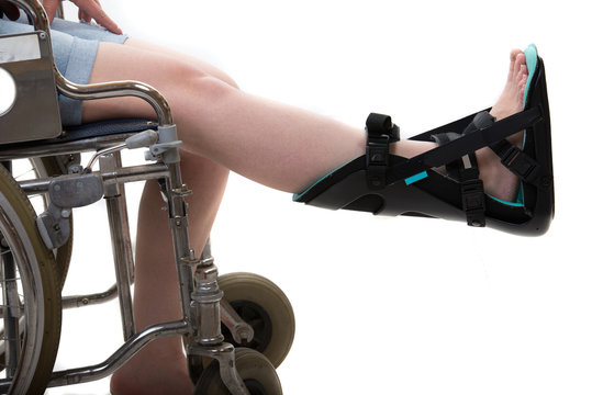 Close up of woman in wheelchair and  night splint foot orthosis