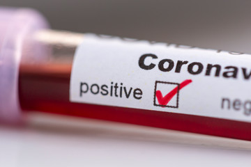 Obraz premium Blood sample for coronavirus testing