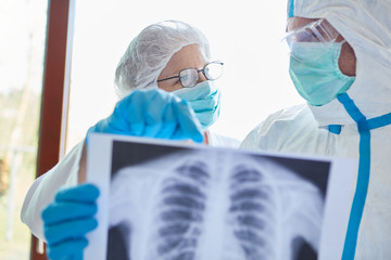 Ärzte in Klinik mit Röntgenbild einer Lungenentzündung