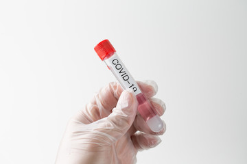 Obraz premium Swab test results of Covid-19 