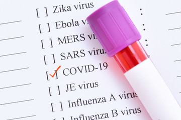 Test tube with blood sample for COVID-19 test