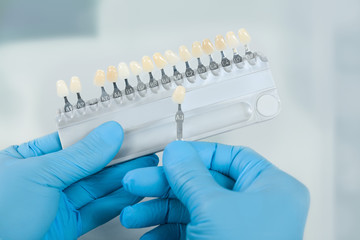 Close up of hands using a shade guide to check veneer of tooth crown in a dental laboratory for...