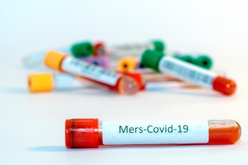 Blood test tubes for coronavirus. - 334231397