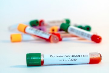 Blood test tubes for coronavirus. - 334231500