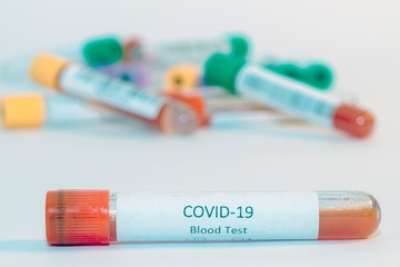 Blood test tubes for coronavirus. - 334231589