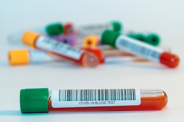 Blood test tubes for coronavirus. - 334231716