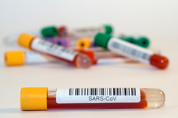 Blood test tubes for coronavirus. - 334232124