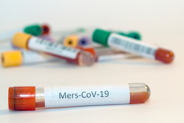 Blood test tubes for coronavirus. - 334232338