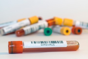 Blood test tubes for coronavirus. - 334232510