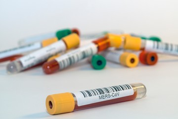 Blood test tubes for coronavirus.