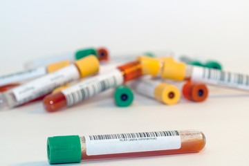 Blood test tubes for coronavirus. - 334232592