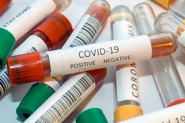 Blood test tubes for coronavirus. - 334232771