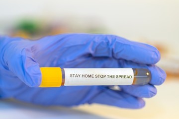 The attendant holds the blood test tube in his hand for corovirus. - 334232952