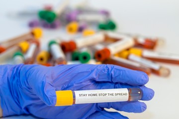 The attendant holds the blood test tube in his hand for corovirus. - 334232981