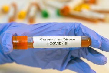 The attendant holds the blood test tube in his hand for corovirus. - 334233316