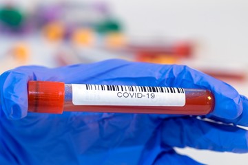 The attendant holds the blood test tube in his hand for corovirus. - 334233534