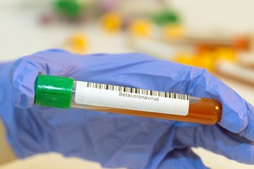The attendant holds the blood test tube in his hand for corovirus. - 334233595