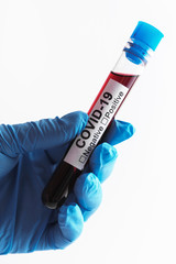 Obraz premium Scientist hand with a blood sample of COVID-19
