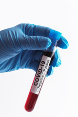 Scientist hand with a blood sample of COVID-19