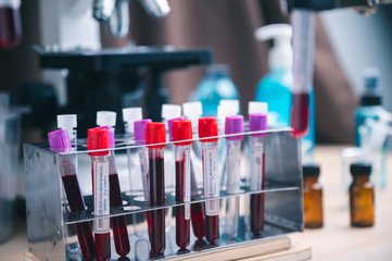 COVID-19 test and laboratory sample of blood testing for diagnosis new Corona virus infection(novel corona virus disease 2019) from Wuhan, China. Pandemic infectious concept