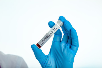A nurse s hand in a glove holds a test tube with the inscription Coronavirus, with a positive blood test for a new rapidly spreading coronavirus, close-up, shallow depth of field, selective focus.