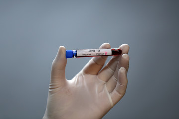 Coronavirus testing - A hand holds a test tube containing a patients sample that has tested positive for coronavirus