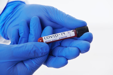 Obraz premium Coronavirus, Doctor holding positive covid-19 virus Blood Sample tube white background