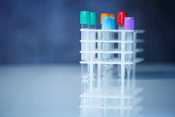 Test tubes for blood analysis. Check for the virus. Medical Devices