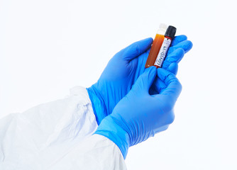 Coronavirus, Doctor holding positive covid-19 virus Blood Sample tube white background