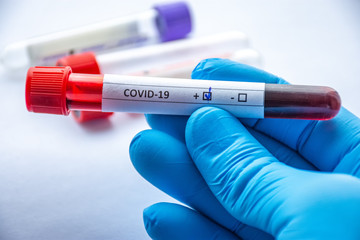 Obraz premium Laboratory diagnosis of coronavirus or COVID-19 concept photos. In close-up frame of doctor laboratory technician hand, which holds tube with blood and marked COVID-19 indicating positive test result