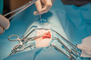 ligature of tissues at the time of surgical operation