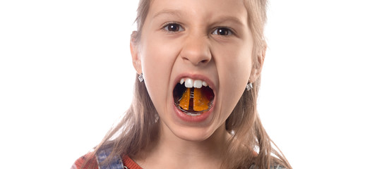 Little cute girl shows her orthodontic appliance on a white background
