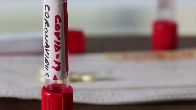 Blood tube with text  Coronavirus alias COVID-19