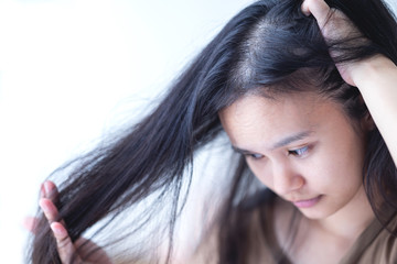 Asian women, hair loss caused by postpartum hormones.