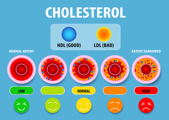 Cholesterol in artery, health risk , vector design