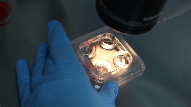 AIDS. HIV. sexually transmitted diseases. a blood test. semen.in the laboratory closeup of glass containers  under a microscope. pregnancy test. anthrax. bird flu. swine flu.