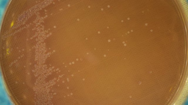 microbial growth in a petri dish time lapse
