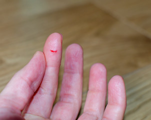 Bleeding from sharp cut wound at left  index. Finger cut, bleeding injured with knife.