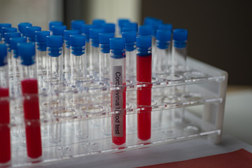 Test Tube Rack with Test Coronavirus Tubes, close up view.  Vaccine COVID 19 SARS-CoV-2 developing  or antibodies blood test concept.