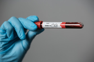 Obraz premium blood tests for the virus coronavirus covid 19