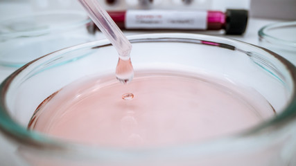 Scientist dropping a sample into a Petri dish. Experimented in laboratory