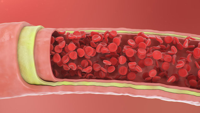 Arterial Images Browse 15 827 Stock Photos Vectors and Video Arterial Images Browse 15 827 Stock Photos Vectors and Video