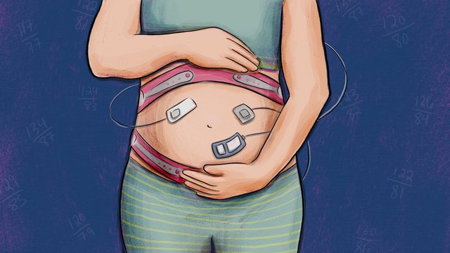 Pregnant Women with Heart Beat Monitor Machines