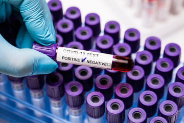 Hands holding positive covid19 test. Medical test-tube with blood samples