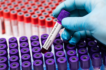 Hands holding negative covid19 test. Medical test-tube with blood samples