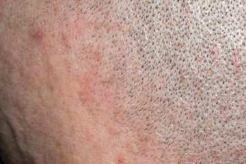 Fototapeta premium Macro photo of short hair on man head.