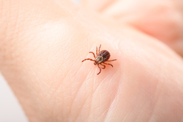 Mite on the human body close-up. The concept of the need to examine the body after walking in the habitat of mites in the season of their activity.