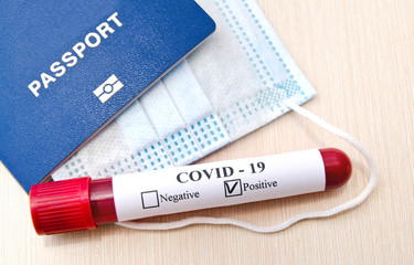 Coronavirus blood test concept.  Test tube with coronavirus positive blood over laboratory desk