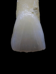 Close up of a natural tooth.